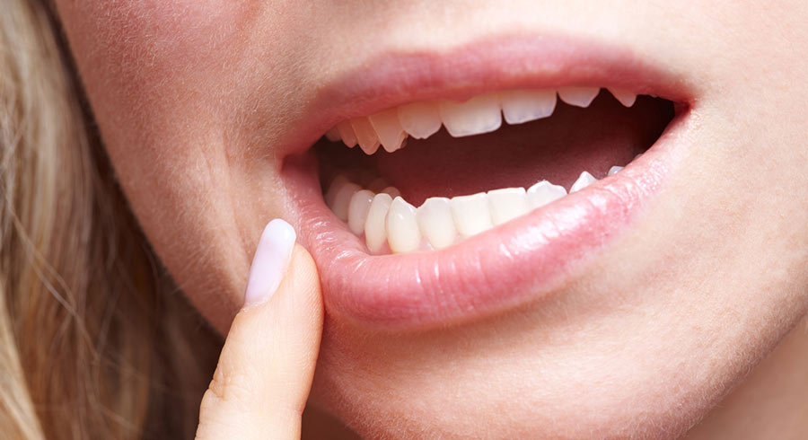 Schutz vor Zahnfleischentzündung - Zahnarztpraxis Essen-Kupferdreh