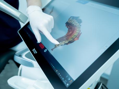 Cerec: Wie funktioniert das?